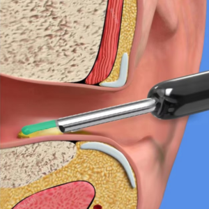 EARPICK_6